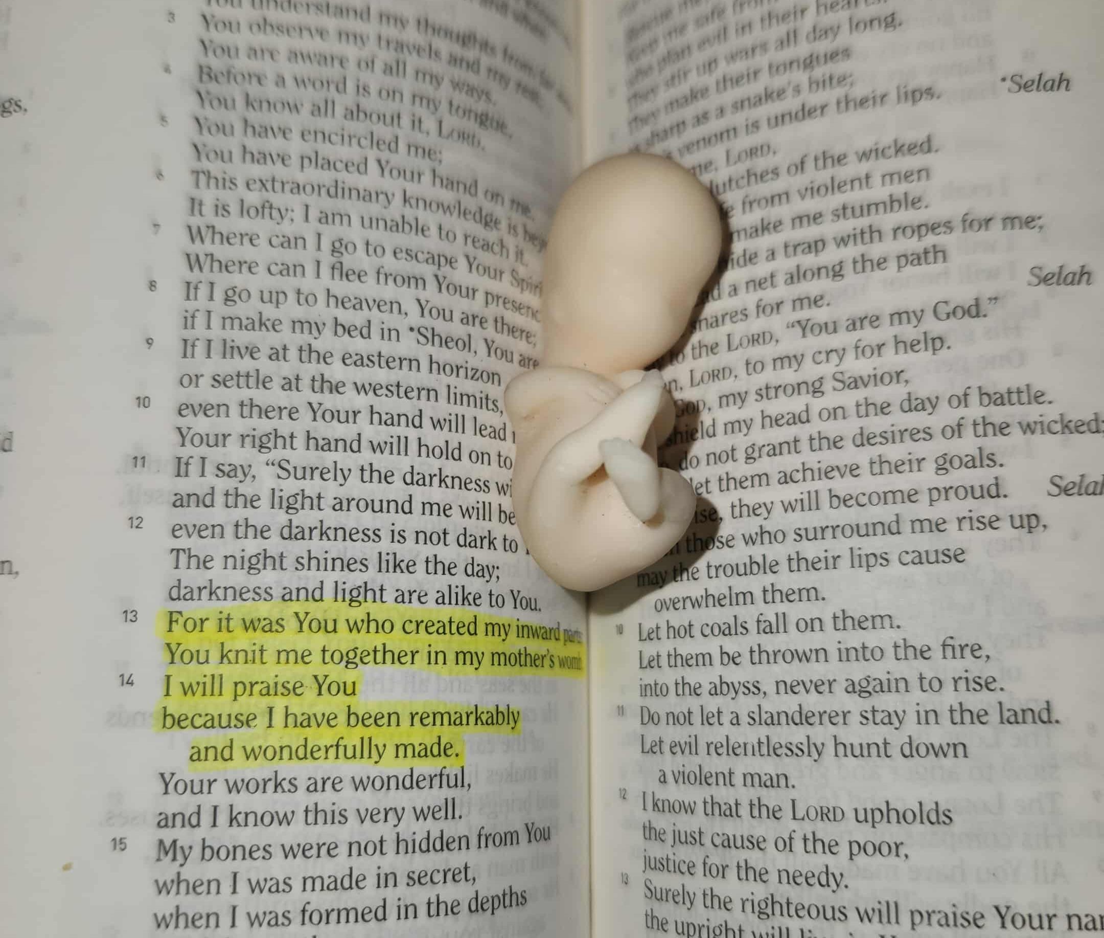 Life At 10 Weeks & The Fight We Face!